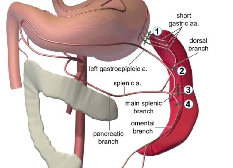 TECA Surgery in Pets